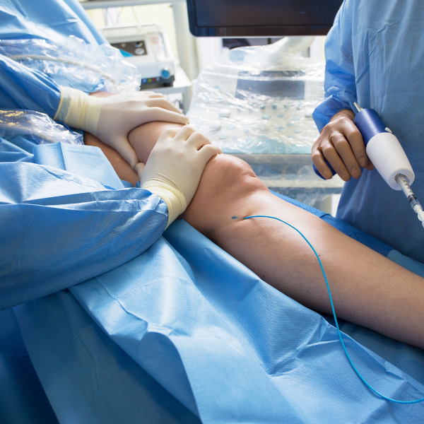 Cirurgia Endovascular: A Revolução no Tratamento Vascular